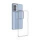 Oppo A57 4g/5g/A77 Transparent Silicone Case